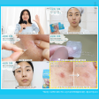 ★Hatherine★ Spot Care Patch Sale