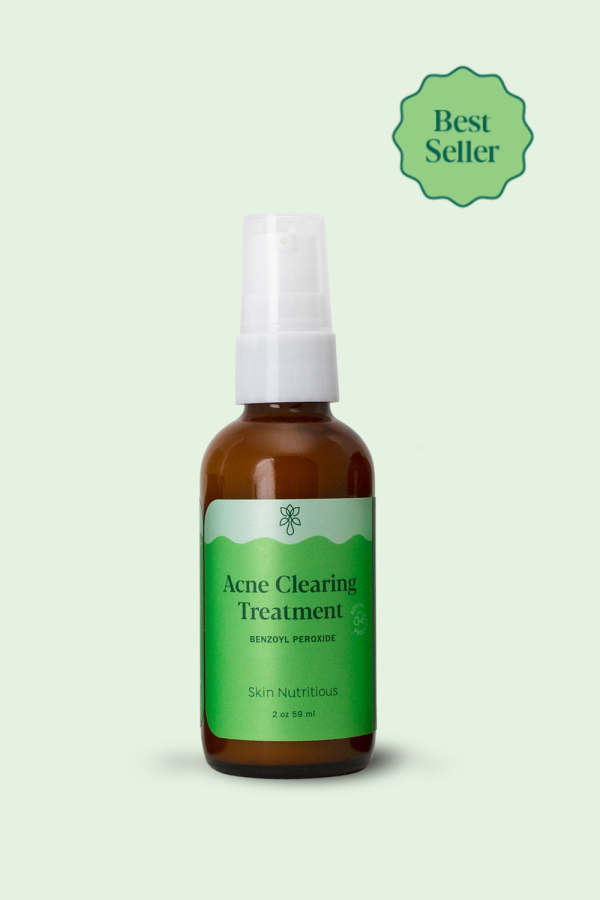 ACNE CLEARING TREATMENT on Sale